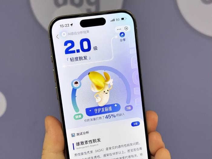 支付宝推出AI毛发自测工具,上传照片即可自测脱发等级